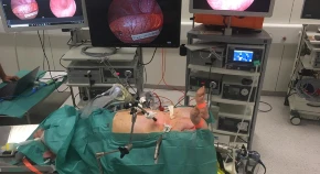 K. Simultaneous computer-assisted assessment of mucosal and serosal perfusion in a model of segmental colonic ischemia
